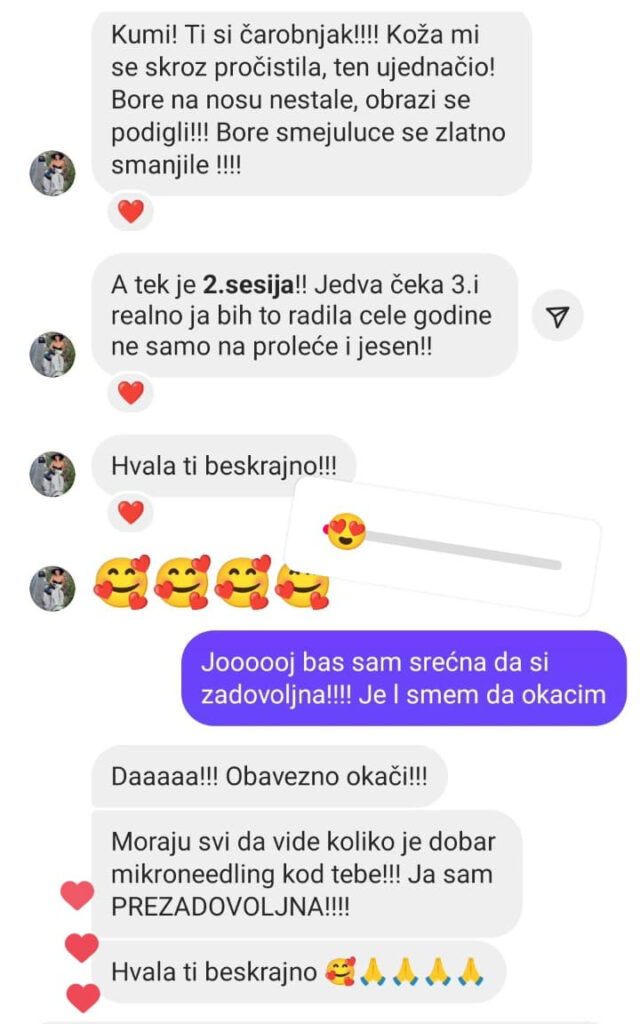 devojka-testemonial-doris-02