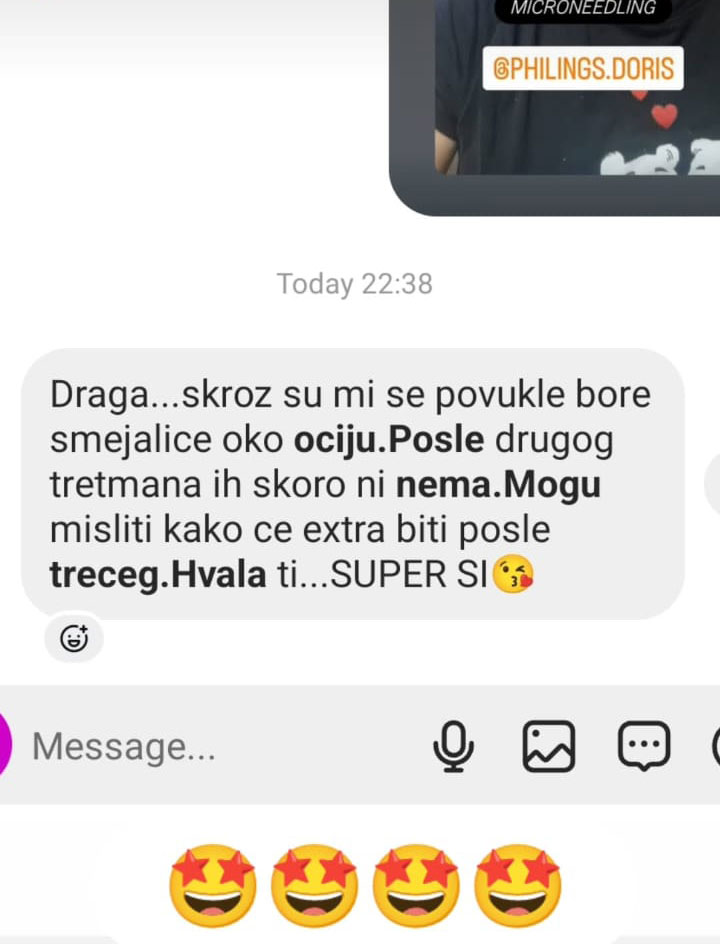 devojka-testemonial-doris-11
